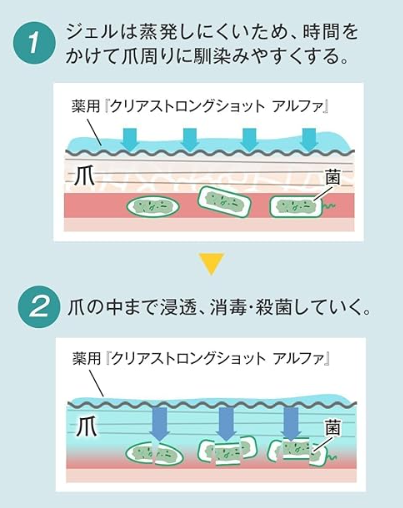 【真相】クリアストロングショットアルファで爪水虫が治るって本当？