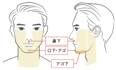 メンズアリシアクリニックのヒゲ脱毛が安い！カミソリ負けからも解放